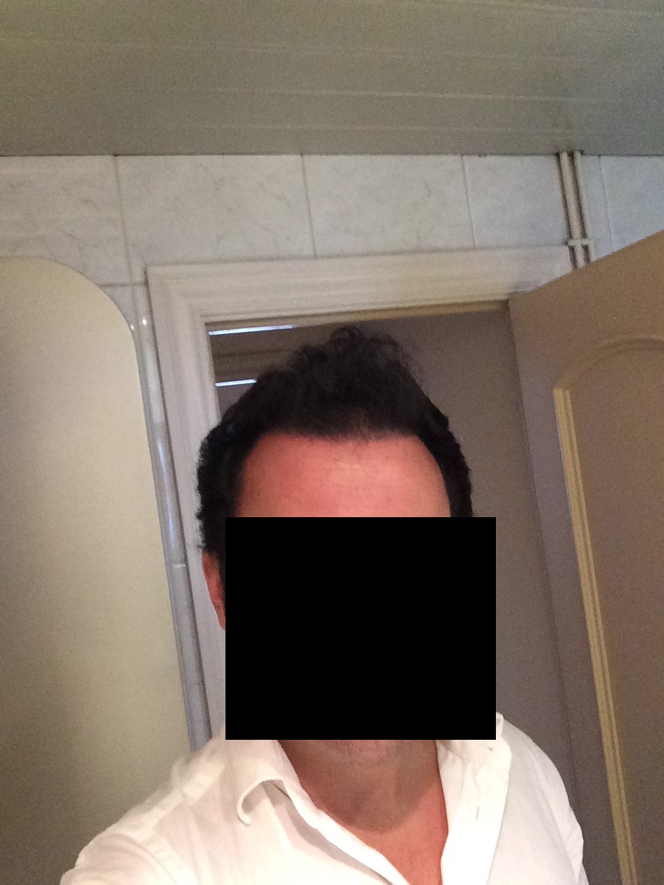 10 meses después del trasplante