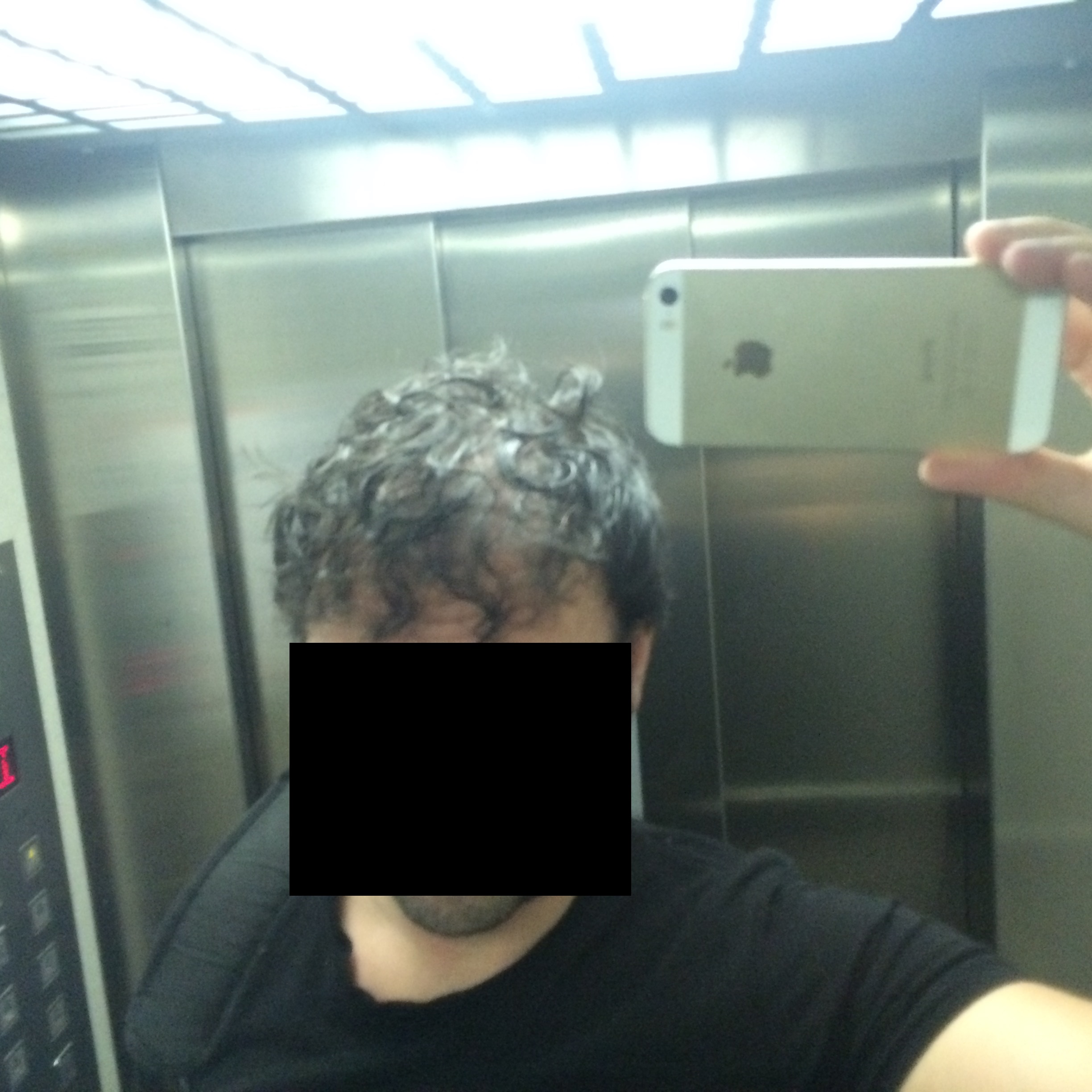 pelo mojado despues del trasplante